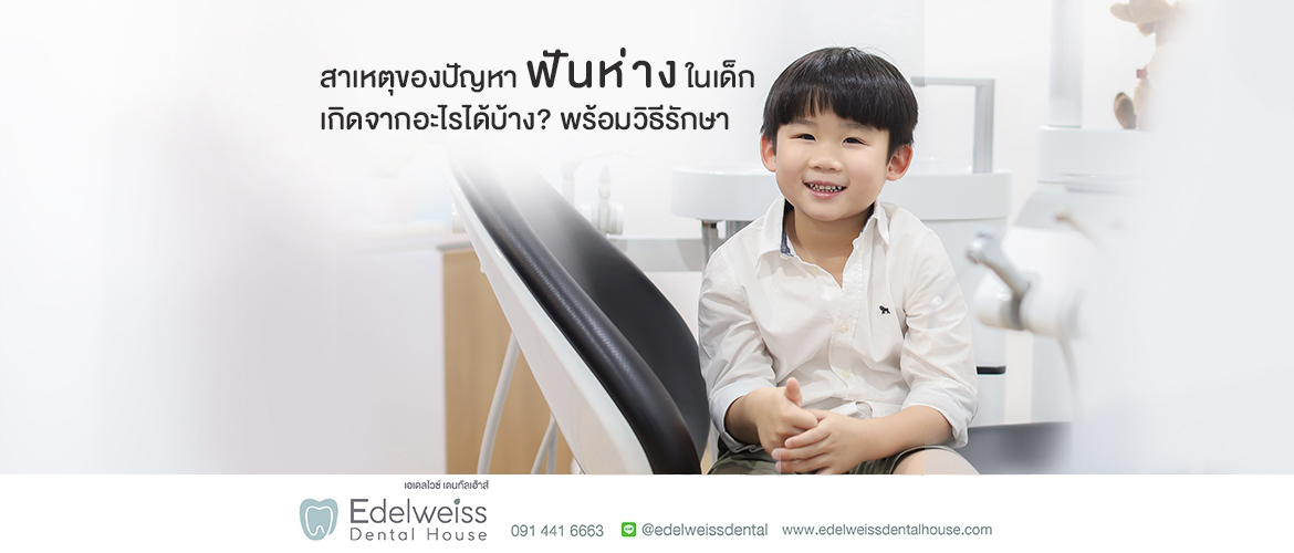 สาเหตุของปัญหาฟันห่างในเด็ก เกิดจากอะไรได้บ้าง พร้อมวิธีรักษาปัญหา